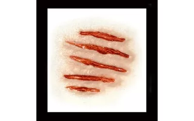 transfers_attacked-450x450